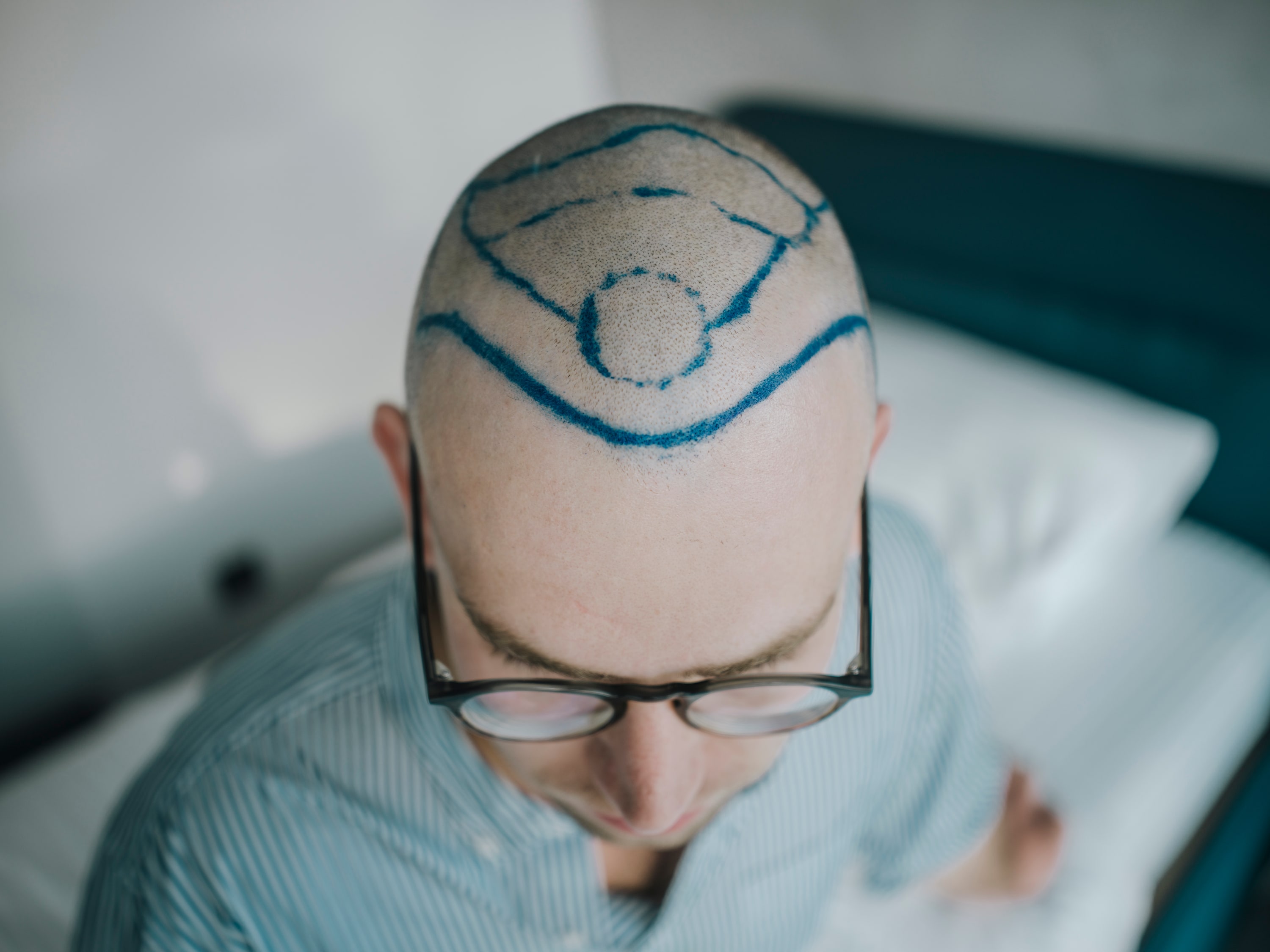Turkish Hairlines - Image 7